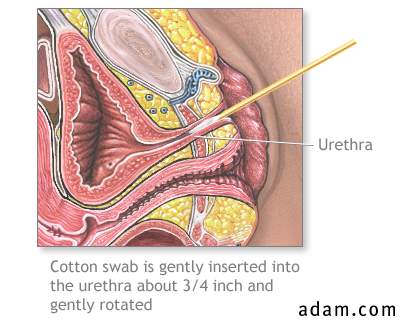 Urethral tissue culture