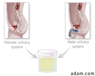 Urine test