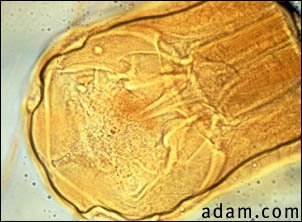 Hookworm - close-up of the organism