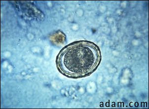 Roundworm eggs - ascariasis