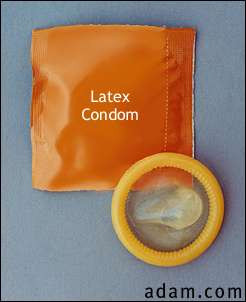 Latex condom (down)