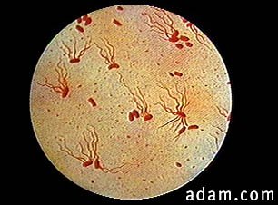 Salmonella typhi organism