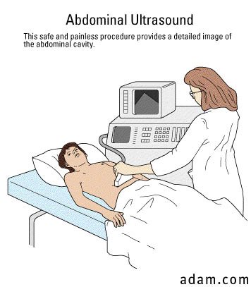 Ultrasound, abdominal