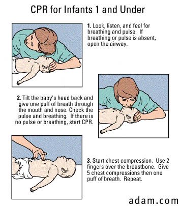 CPR on infants under 1 year