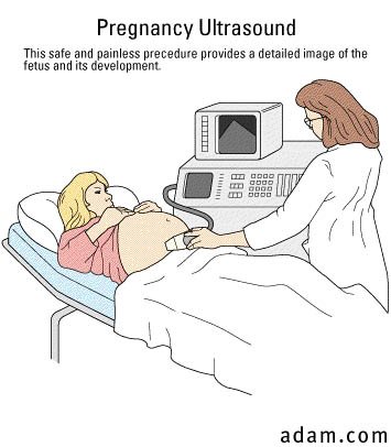Ultrasound, pregnancy