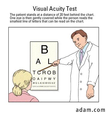 Visual acuity test