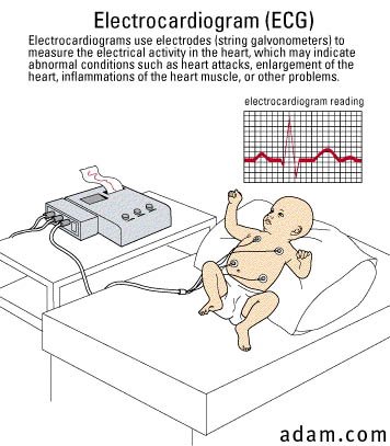 ECG - infant