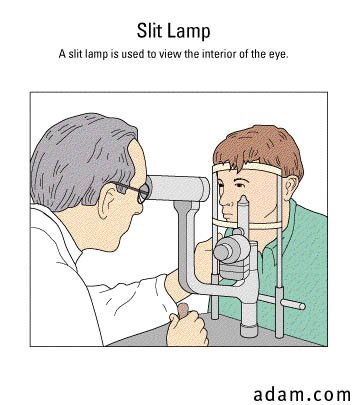 Slit-lamp test