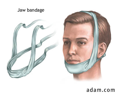 Jaw Bandage