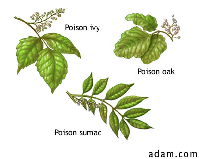 Poison Oak, Ivy & Sumac