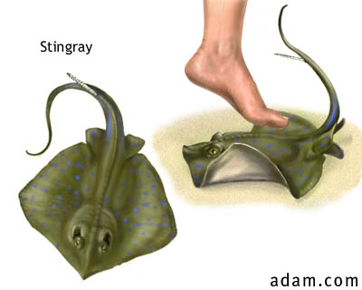 Stingray