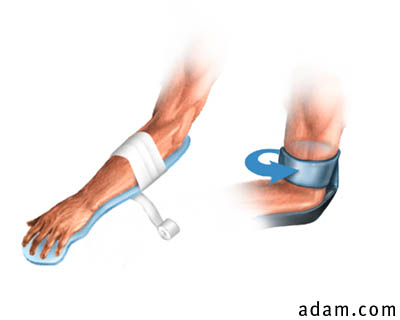 Wrist, Forearm, and Elbow Splint