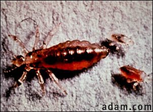 Body louse, female and larvae
