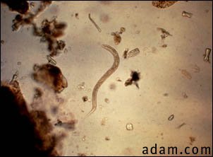 Hookworm rhabditiform larva