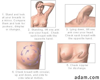 Self breast exam