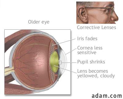Aged eye anatomy