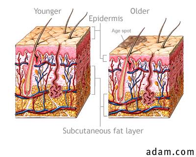 Changes in skin with age