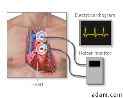 Holter heart monitor