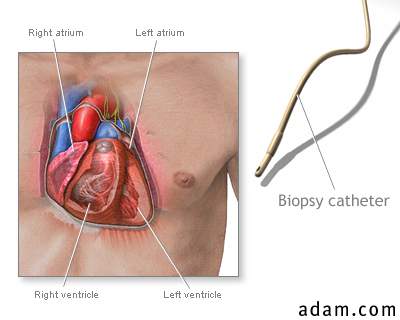 Heart catheter