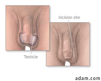 Testicular biopsy