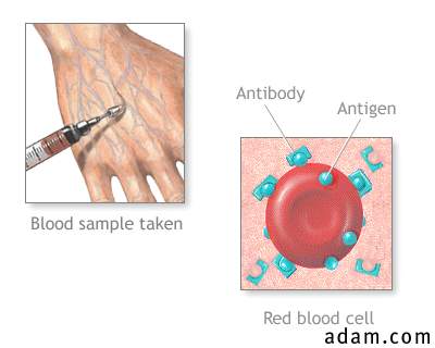 Antibody titer