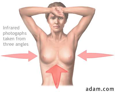Ultrasonic breast exam