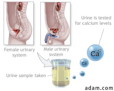 Calcium urine test