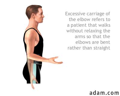 Carriage elbow angle