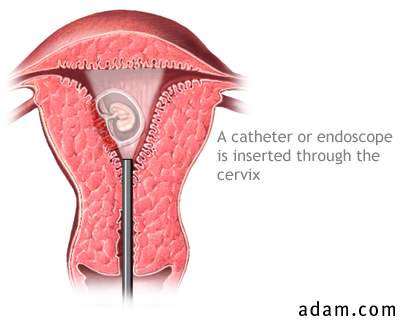Cervical endoscope