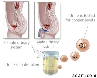 Copper urine test