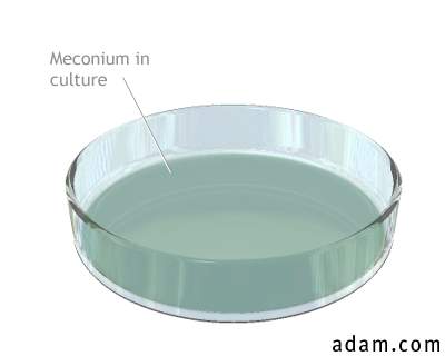 Meconium culture