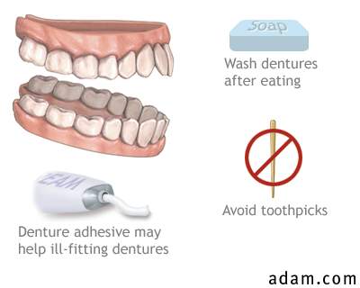 Denture problems
