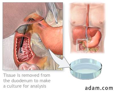 Duodenum tissue culture