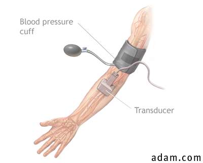 Blood pressure and transducer