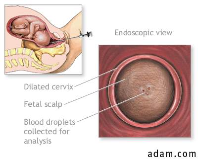Fetal blood testing