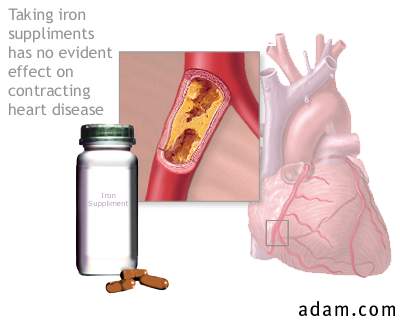 Iron supplements