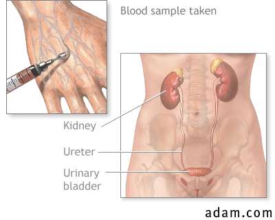 Kidney function tests