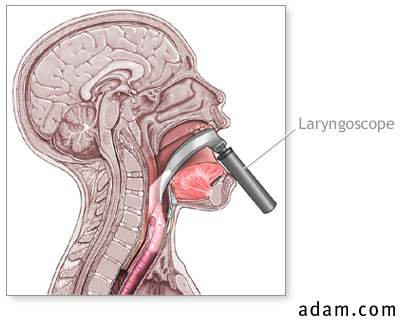 Laryngoscopy