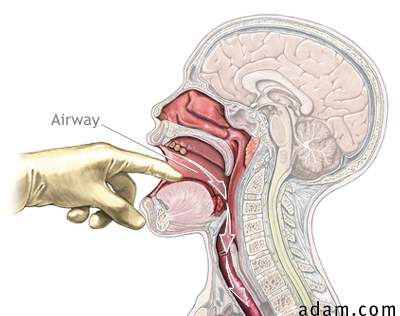 Check airway