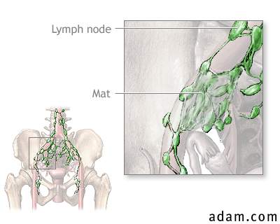Pelvic lymph tissue