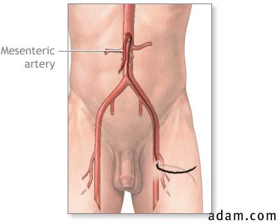 Mesenteric arteriography