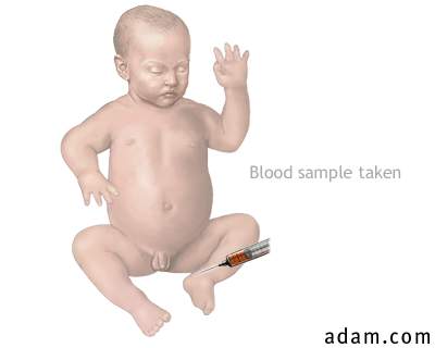 Infant blood sample