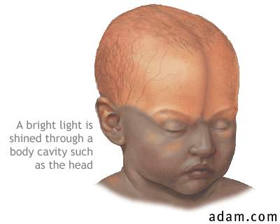 Infant brain test