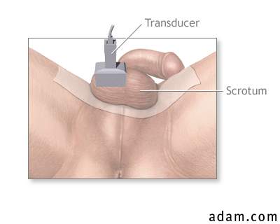Tesitcular ultrasound