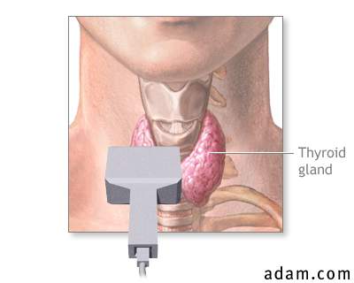 Thyroid ultrasound